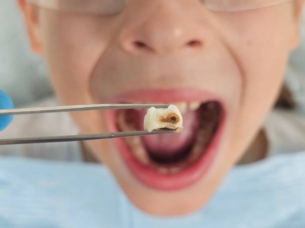 Best Pediatric Emergency Dentist in Brewster, OH